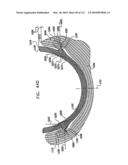 Foldable Prosthetic Implant Element diagram and image