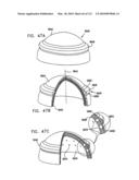 Foldable Prosthetic Implant Element diagram and image