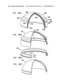 Foldable Prosthetic Implant Element diagram and image