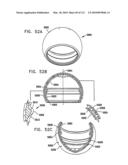 Foldable Prosthetic Implant Element diagram and image