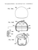 Foldable Prosthetic Implant Element diagram and image