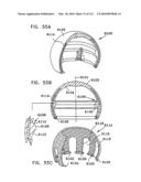 Foldable Prosthetic Implant Element diagram and image