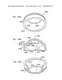 Foldable Prosthetic Implant Element diagram and image