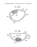 Foldable Prosthetic Implant Element diagram and image