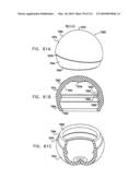 Foldable Prosthetic Implant Element diagram and image