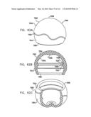 Foldable Prosthetic Implant Element diagram and image