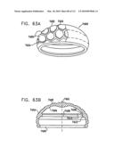 Foldable Prosthetic Implant Element diagram and image