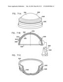 Foldable Prosthetic Implant Element diagram and image