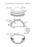 Foldable Prosthetic Implant Element diagram and image