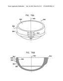 Foldable Prosthetic Implant Element diagram and image