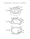 Foldable Prosthetic Implant Element diagram and image