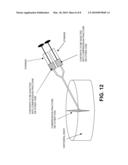 METHOD AND APPARATUS FOR TREATING COMPRESSION FRACTURES IN VERTEBRAL BODIES diagram and image