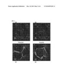 Method and System for Generating a Personalized Anatomical Heart Model diagram and image