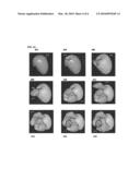 Method and System for Generating a Personalized Anatomical Heart Model diagram and image