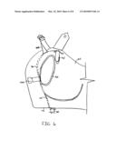 BALLISTIC RESISTANT GARMENT QUICK RELEASE SYSTEM diagram and image