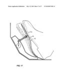 PEDAL DEVICE OF AUTOMOTIVE VEHICLE diagram and image