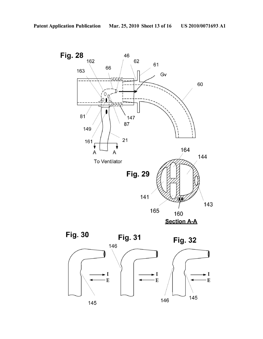 METHODS AND DEVICES FOR PROVIDING MECHANICAL VENTILATION WITH AN OPEN AIRWAY INTERFACE - diagram, schematic, and image 14