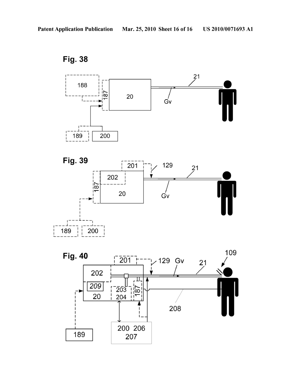 METHODS AND DEVICES FOR PROVIDING MECHANICAL VENTILATION WITH AN OPEN AIRWAY INTERFACE - diagram, schematic, and image 17