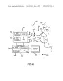 MODEL-PREDICTIVE ONLINE IDENTIFICATION OF PATIENT RESPIRATORY EFFORT DYNAMICS IN MEDICAL VENTILATORS diagram and image