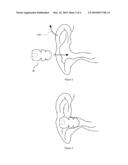 NOVEL HEARING PROTECTION DEVICE AND METHOD AND SECURE EARBUD ASSEMBLY diagram and image