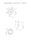 Reclining Device diagram and image