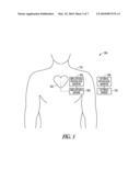 SYSTEM AND METHOD FOR DETECTION OF HF DECOMPENSATION BASED ON SIGNS AND SYMPTOMS diagram and image