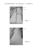 CAMERA-BASED DOCUMENT IMAGING diagram and image