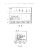 X-RAY COMPUTERIZED TOMOGRAPHY APPARATUS, BREATHING INDICATION APPARATUS AND MEDICAL IMAGING APPARATUS diagram and image