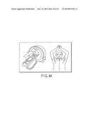 X-RAY COMPUTERIZED TOMOGRAPHY APPARATUS, BREATHING INDICATION APPARATUS AND MEDICAL IMAGING APPARATUS diagram and image