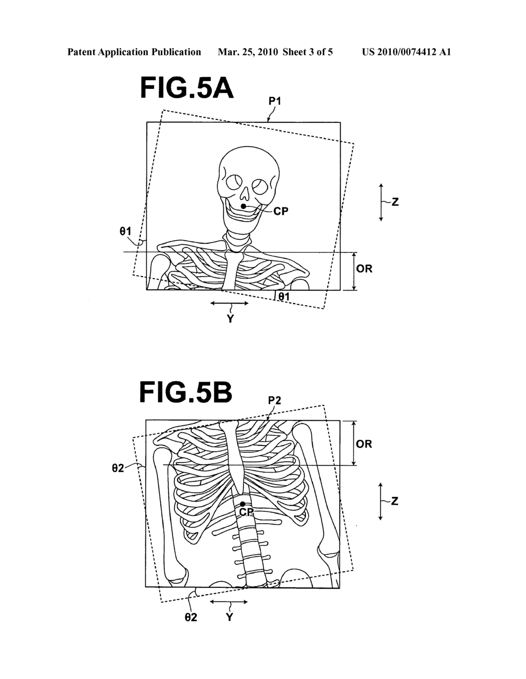 Radiographic image detection apparaus - diagram, schematic, and image 04