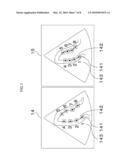 MEDICAL IMAGE DIAGNOSTIC DEVICE diagram and image