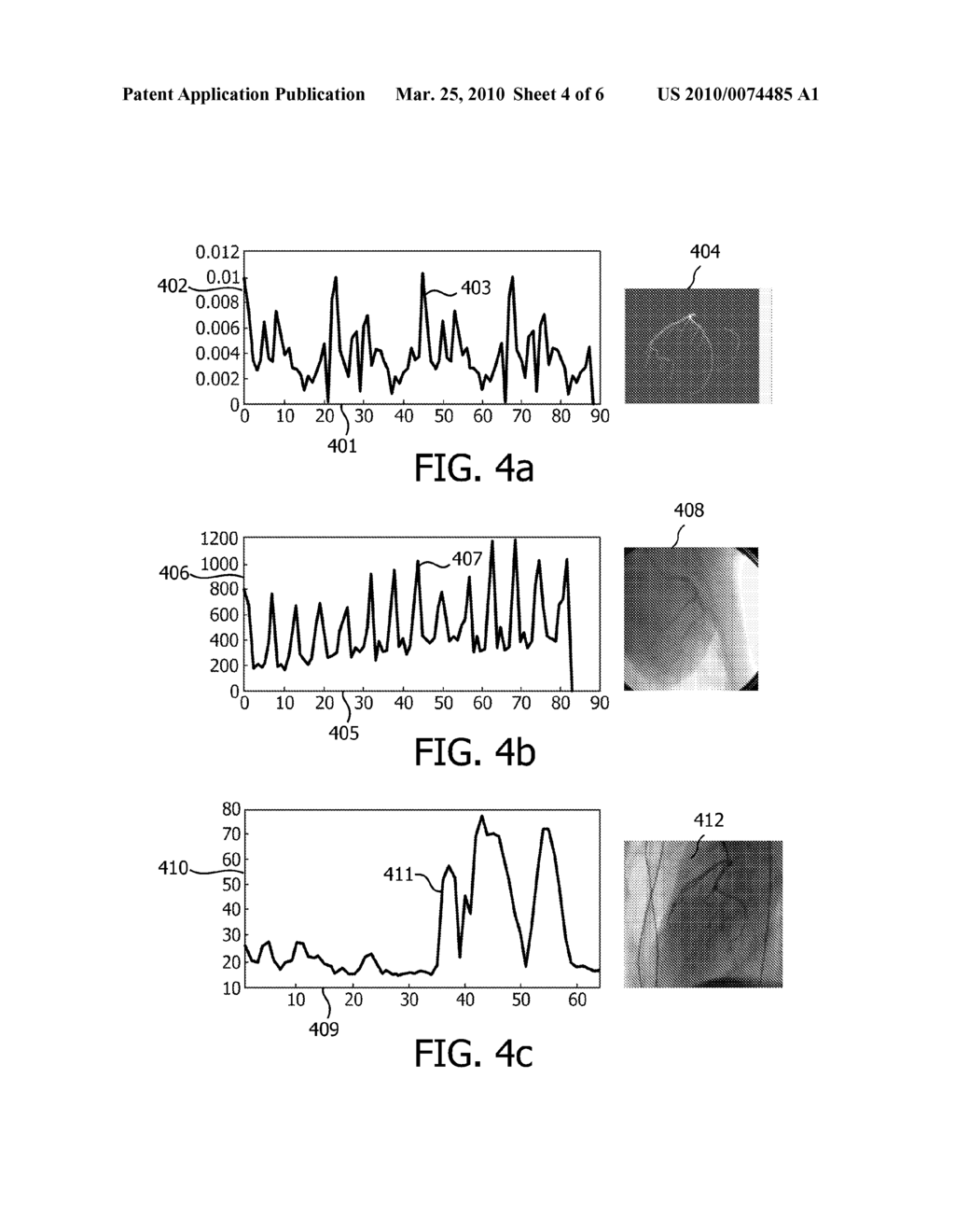 CARDIAC PHASE DETERMINATION - diagram, schematic, and image 05