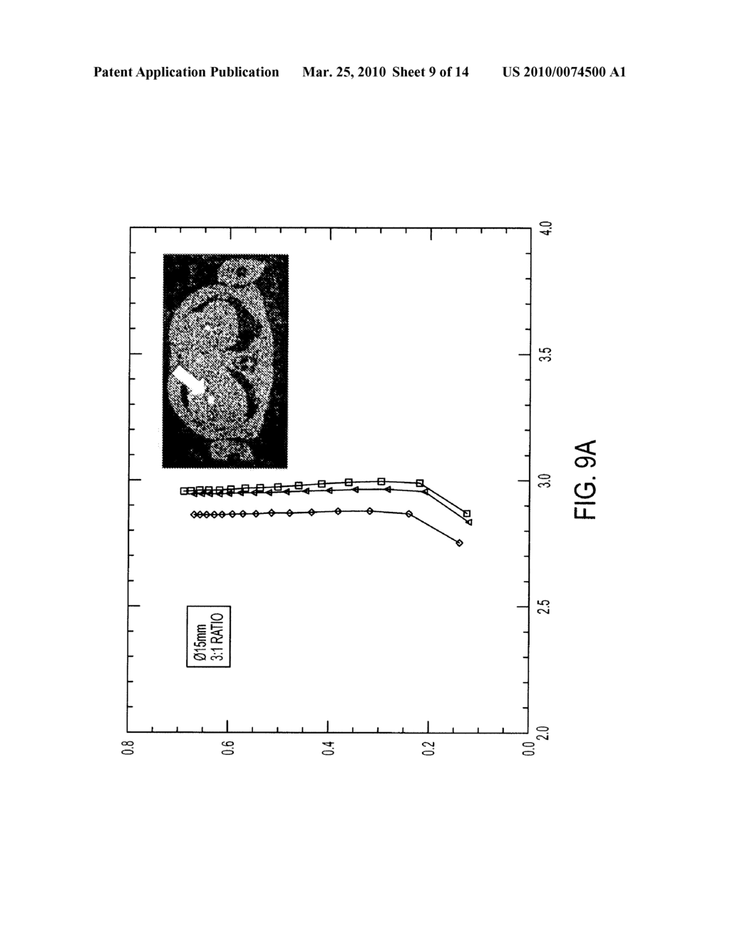 SYSTEM AND METHOD FOR 3D TIME OF FLIGHT PET FORWARD PROJECTION BASED ON AN EXACT AXIAL INVERSE REBINNING RELATION IN FOURIER SPACE - diagram, schematic, and image 10