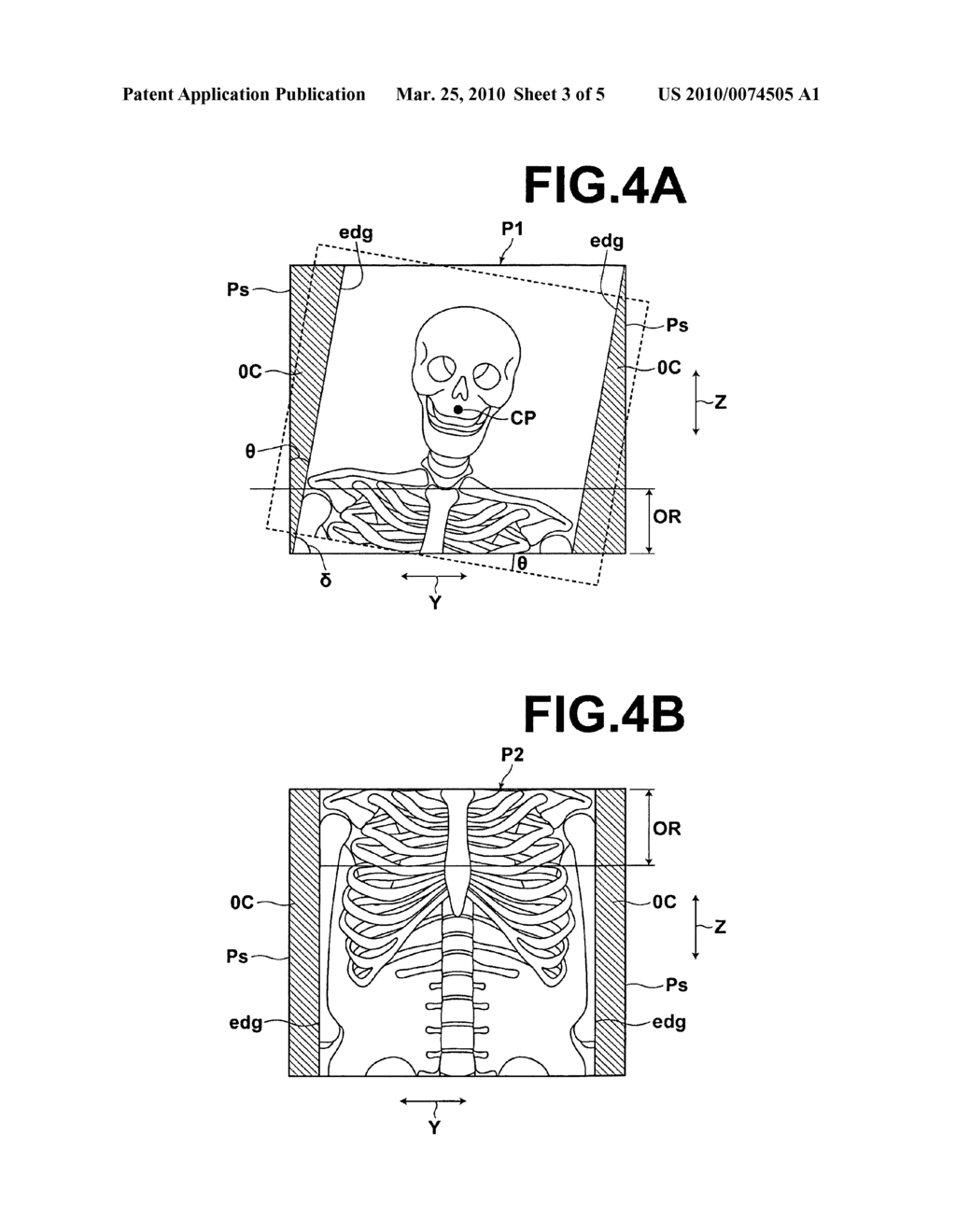 Radiographic image detection apparatus - diagram, schematic, and image 04