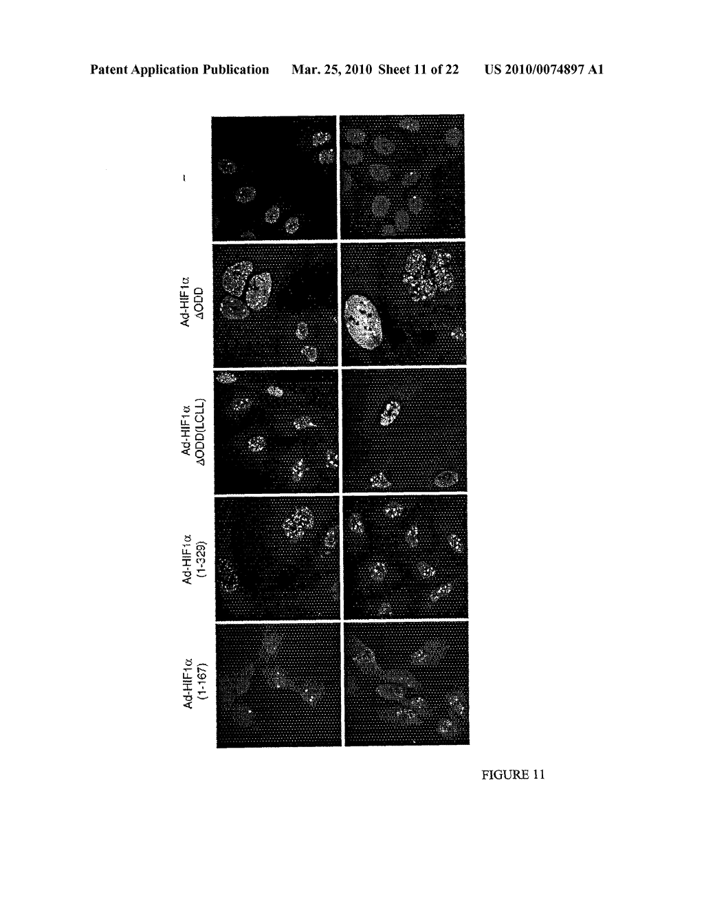 Methods and Compositions related to HIF-1 alpha - diagram, schematic, and image 12