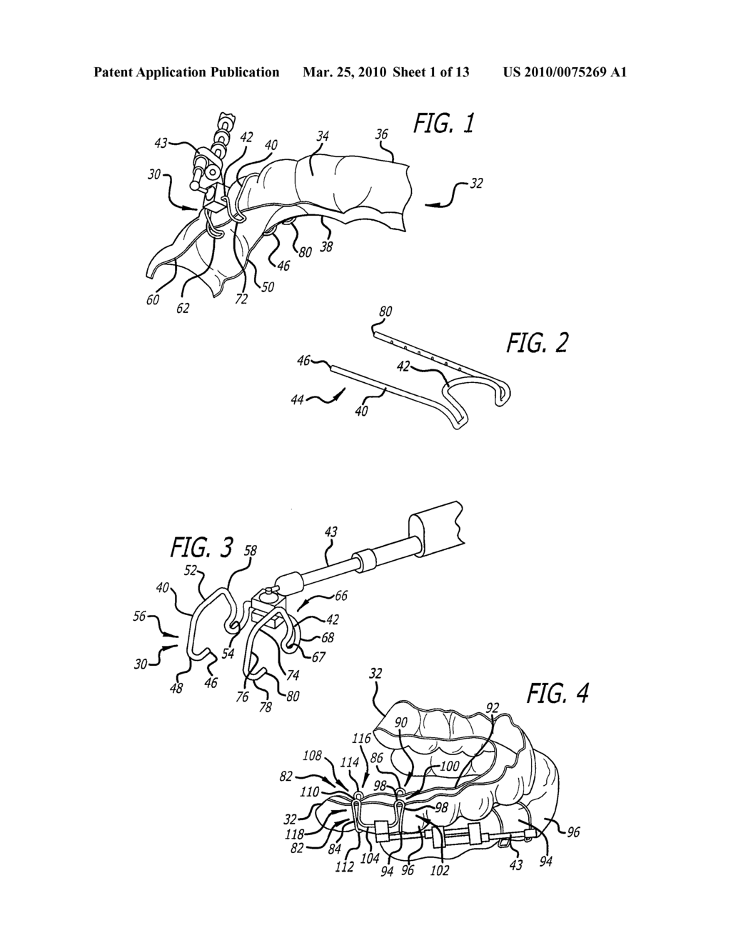 ACCESSORY MOUNTING CLIP FOR ORTHODONTIC ALIGNER TRAYS - diagram, schematic, and image 02