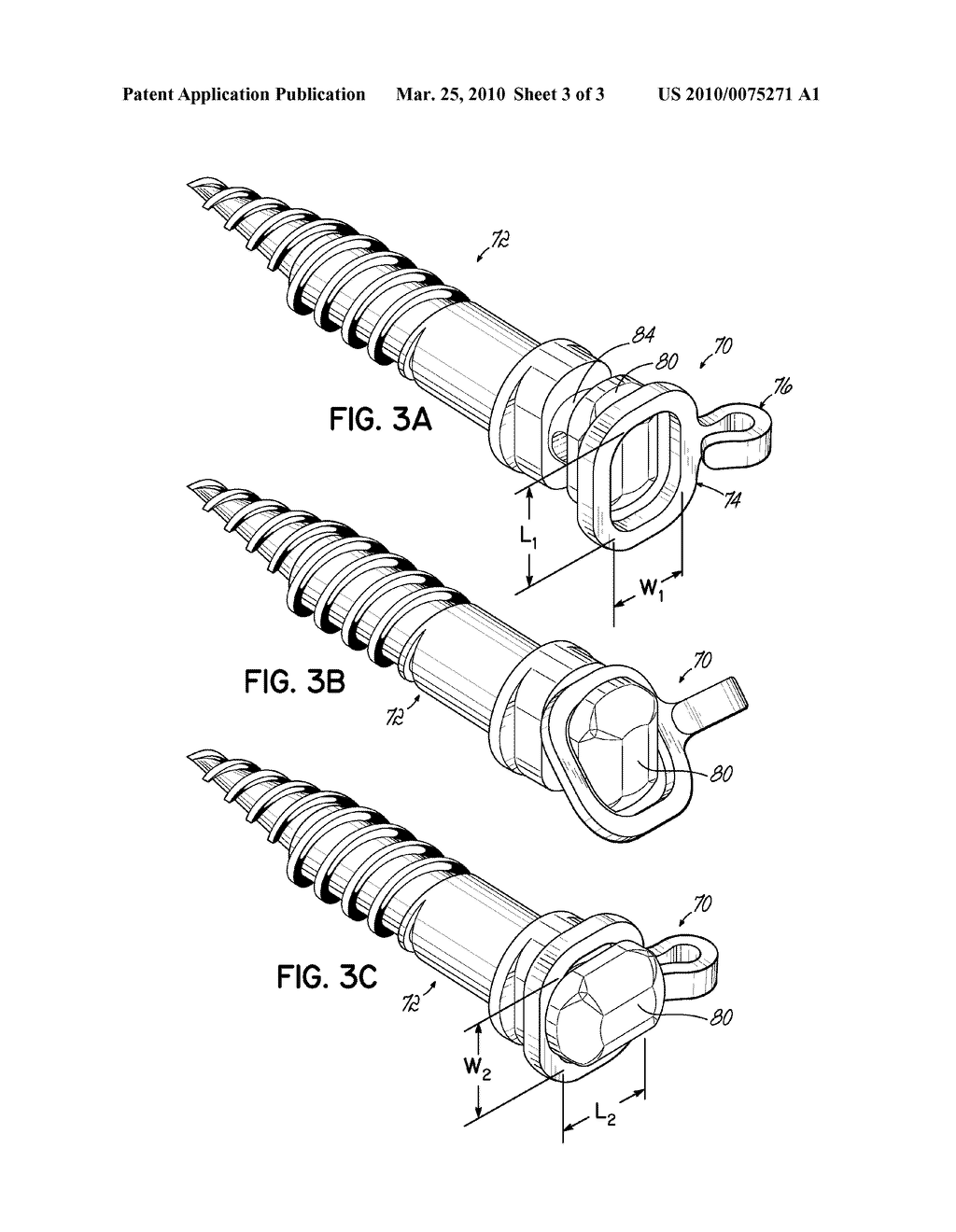 ORTHODONTIC EYELET WITH CRIMPABLE PORTIONS AND RELATED METHODS - diagram, schematic, and image 04