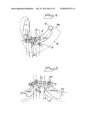 ARRANGEMENT AND DEVICE FOR USING A TEMPLATE TO FORM HOLES FOR IMPLANTS IN BONE, PREFERABLY JAW BONE diagram and image