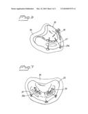 ARRANGEMENT AND DEVICE FOR USING A TEMPLATE TO FORM HOLES FOR IMPLANTS IN BONE, PREFERABLY JAW BONE diagram and image