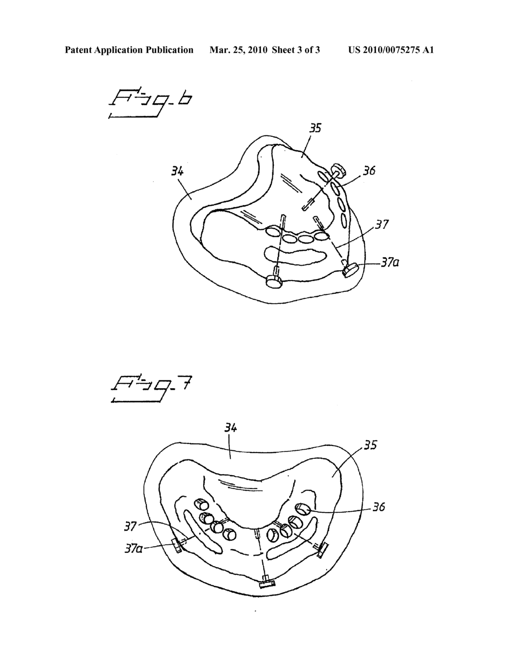 ARRANGEMENT AND DEVICE FOR USING A TEMPLATE TO FORM HOLES FOR IMPLANTS IN BONE, PREFERABLY JAW BONE - diagram, schematic, and image 04