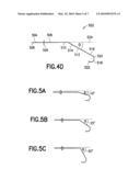 Device for Use in a Surgical Procedure on a Human Eye diagram and image