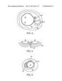 Inducing Desirable Temperature Effects On Body Tissue Using Alternate Energy Sources diagram and image