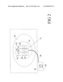 METHOD AND APPARATUS FOR HANDS-FREE ULTRASOUND diagram and image