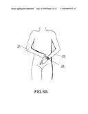 Device and Method for Measuring Three-Lead ECG in a Wristwatch diagram and image