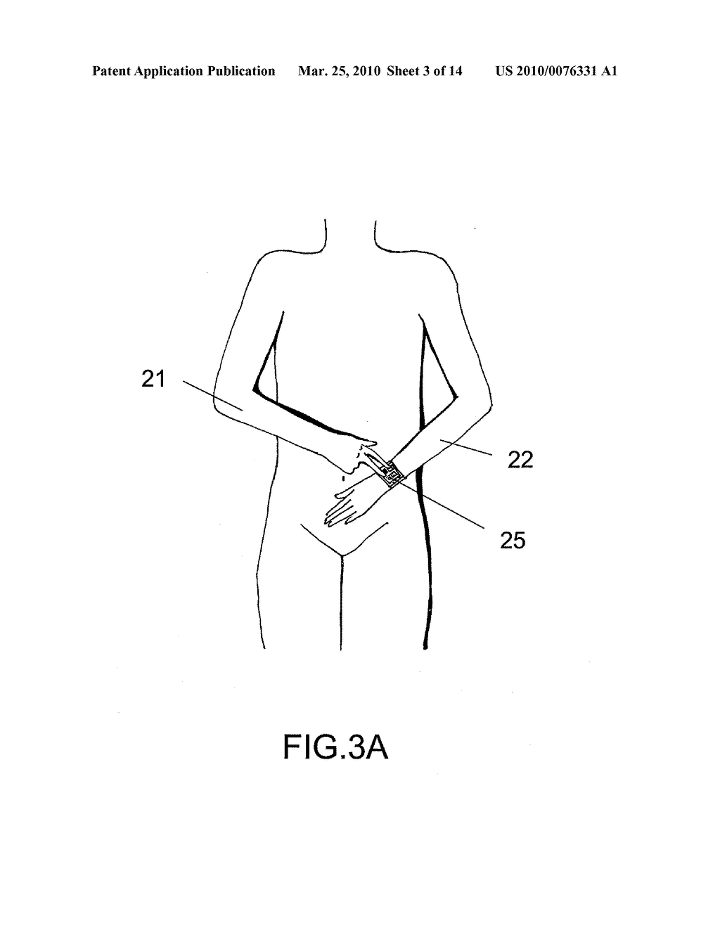 Device and Method for Measuring Three-Lead ECG in a Wristwatch - diagram, schematic, and image 04