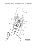 Device and Method for Measuring Three-Lead ECG in a Wristwatch diagram and image