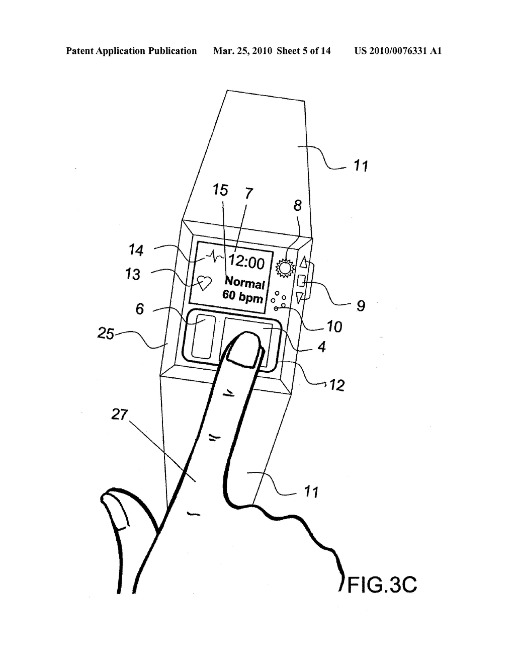 Device and Method for Measuring Three-Lead ECG in a Wristwatch - diagram, schematic, and image 06