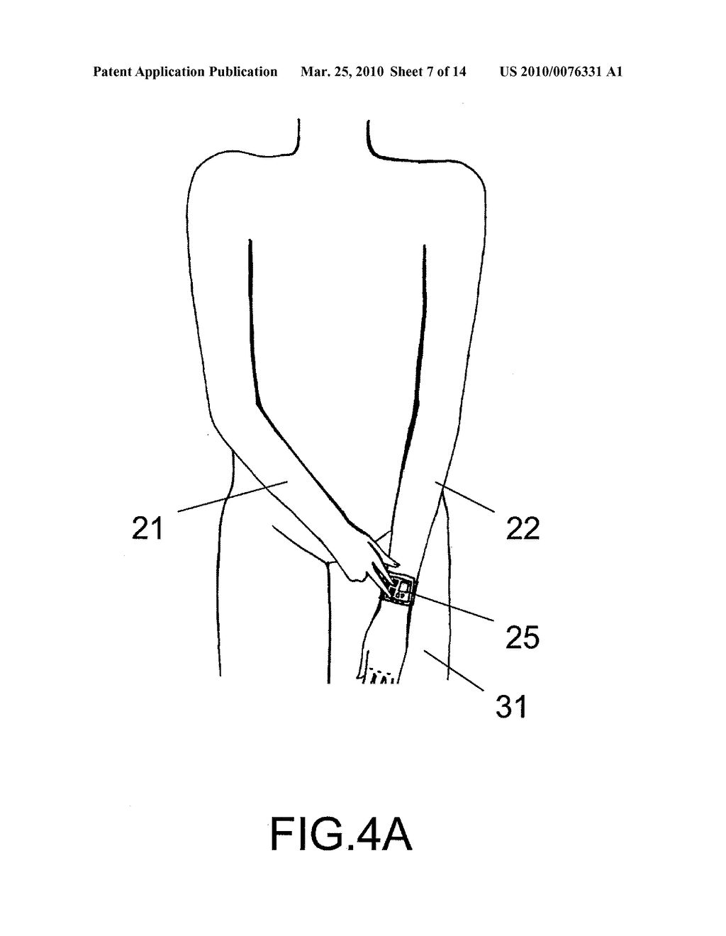 Device and Method for Measuring Three-Lead ECG in a Wristwatch - diagram, schematic, and image 08