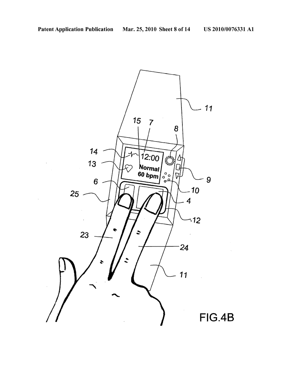 Device and Method for Measuring Three-Lead ECG in a Wristwatch - diagram, schematic, and image 09