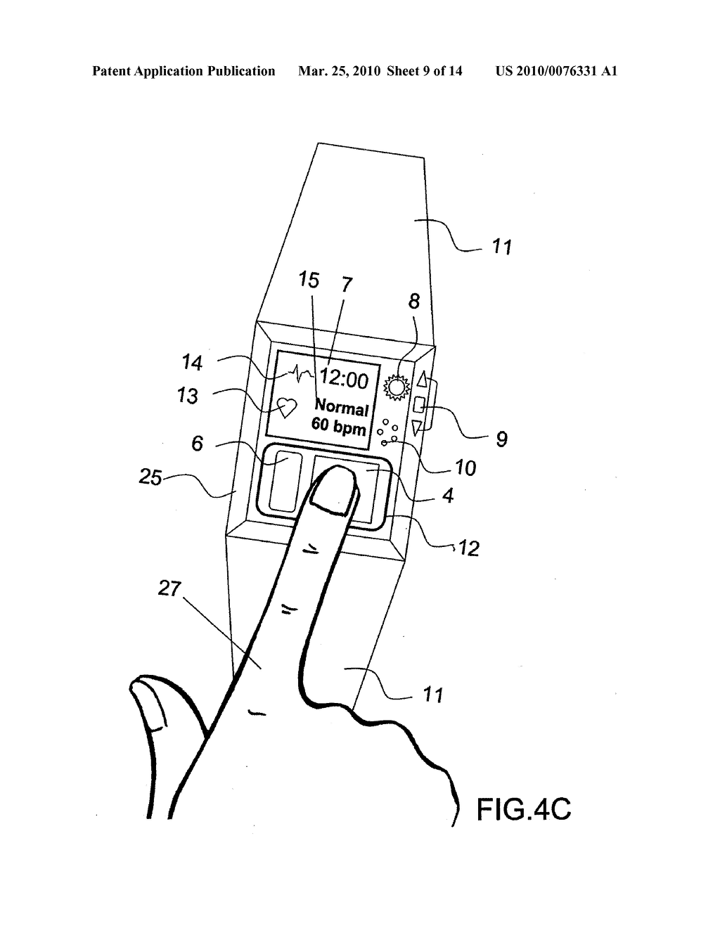 Device and Method for Measuring Three-Lead ECG in a Wristwatch - diagram, schematic, and image 10